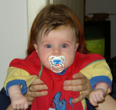 Mama und Kyra: Mysteriöser Haarwuchs